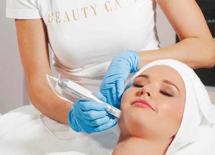 Microneedling